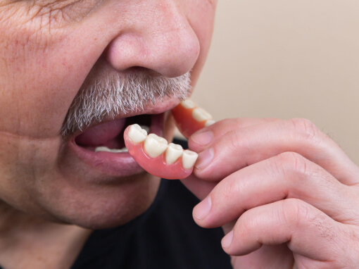 Implantologie - Soins dentaires Ravis